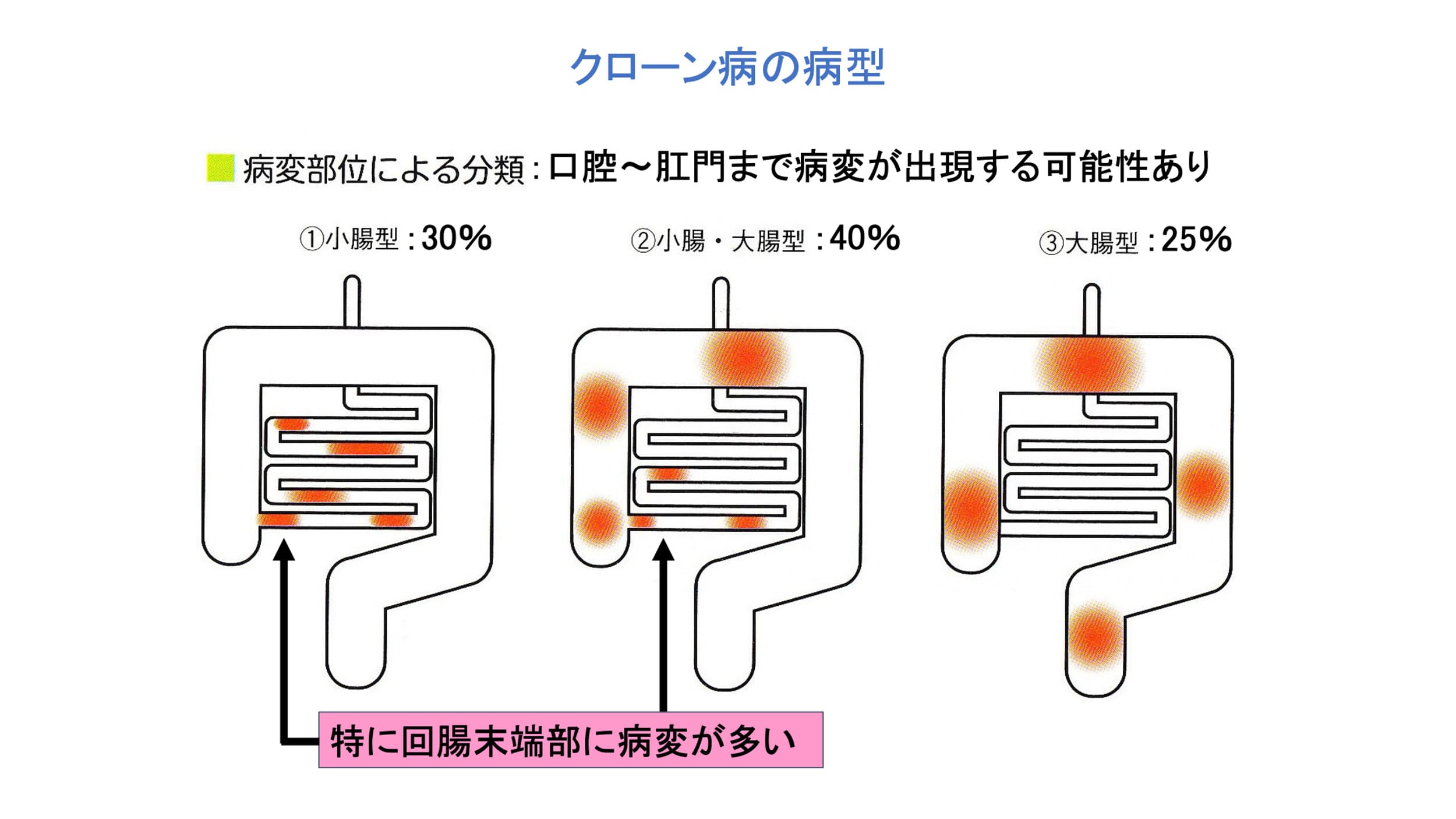 病型