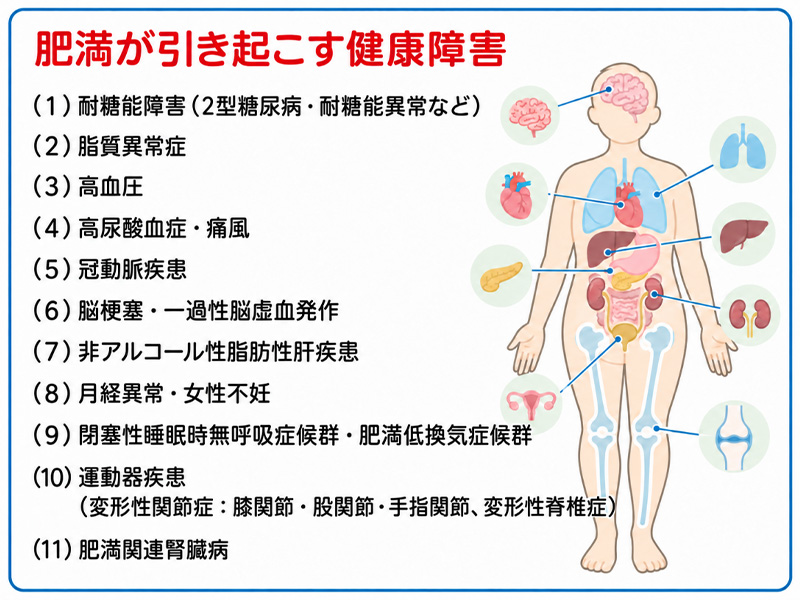肥満が引き起こす健康障害の一覧。(1)耐糖能障害(2型糖尿病・耐糖能異常など)、(2)脂質異常症、(3)高血圧、(4)高尿酸血症・痛風、(5)冠動脈疾患、(6)脳梗塞・一過性脳虚血発作、(7)非アルコール性脂肪性肝疾患、(8)月経異常・女性不妊、(9)閉塞性睡眠時無呼吸症候群・肥満低換気症候群、(10)運動器疾患(変形性関節症:膝関節・股関節・手指関節、変形性脊椎症)、(11)肥満関連腎臓病。